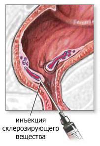"Инъекция